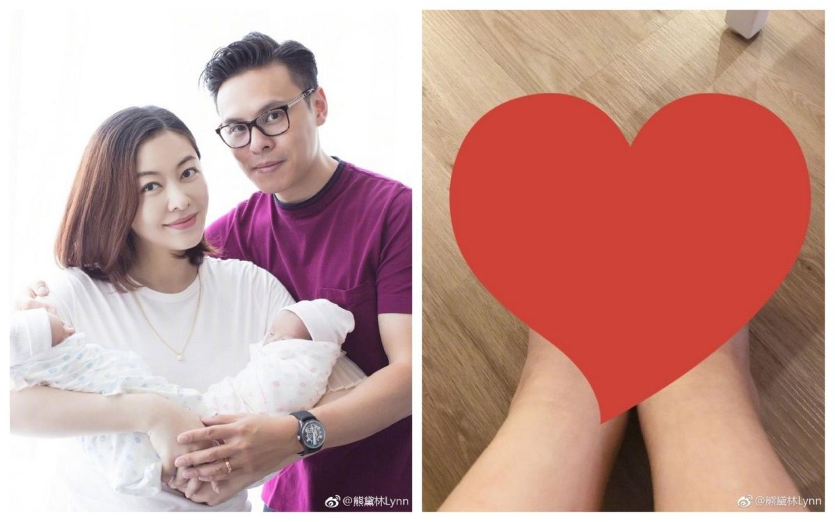 ▲熊黛林PO出雙腳因懷孕水腫的照片，網友驚呆！（圖／翻攝熊黛林微博 , 2018.04.30）