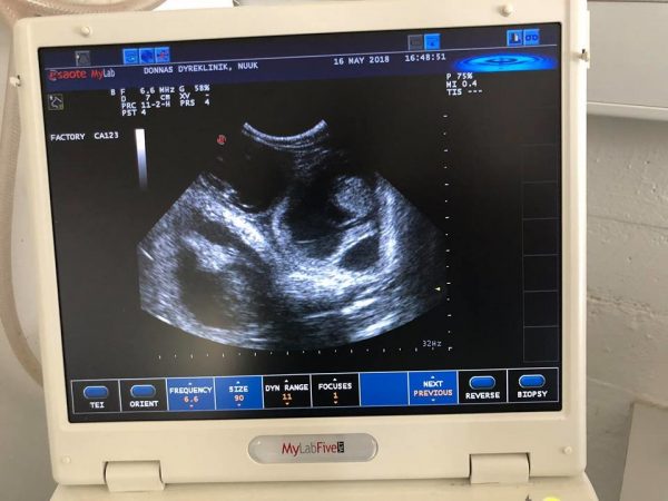 超音波顯示，烏拉的肚子裡的確有小寶寶了！