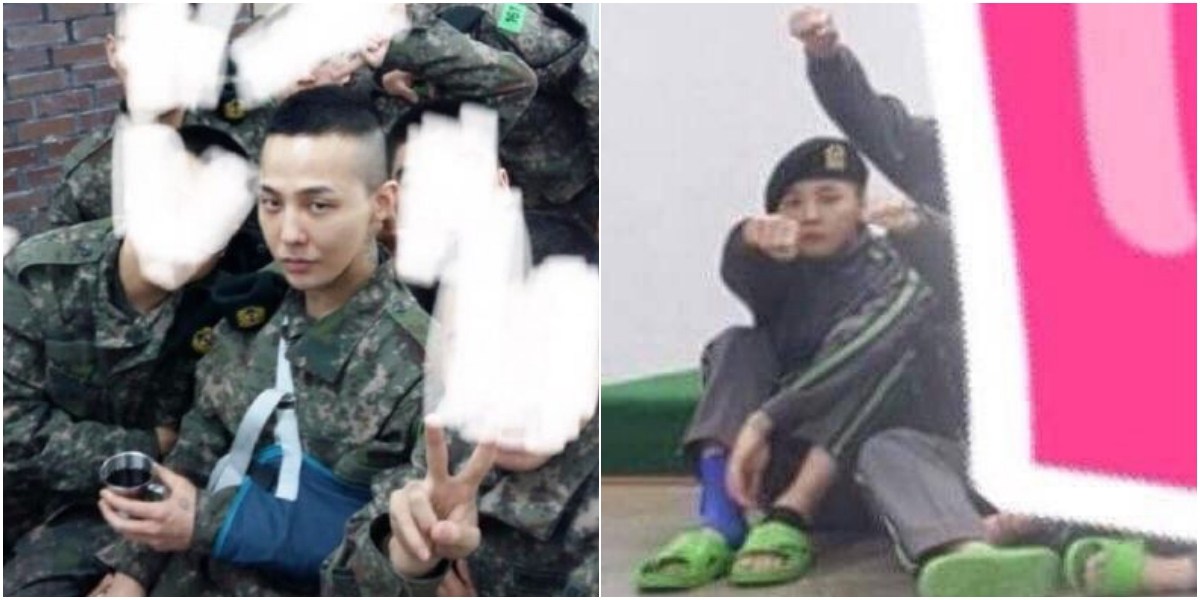 ▲GD日前受傷照外流。（圖／IG , 2018.5.17）