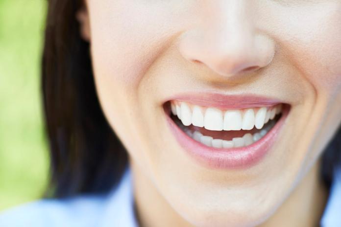 牙齒潔白展現迷人風采　隱形美白貼片讓笑容更自信
