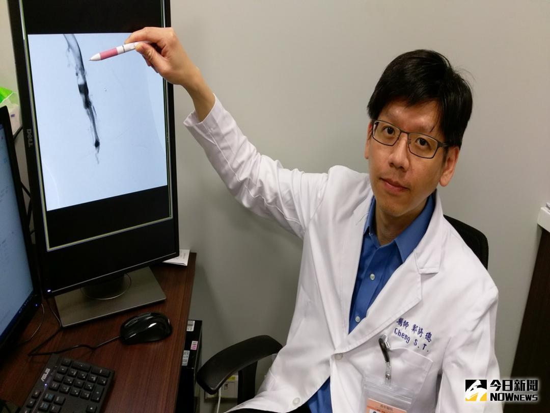 ▲長安醫院心臟血管科醫生鄭詩璁解說有關下肢深層靜脈栓塞病情。（圖／林重鎣攝 , 2018.5.23\\)