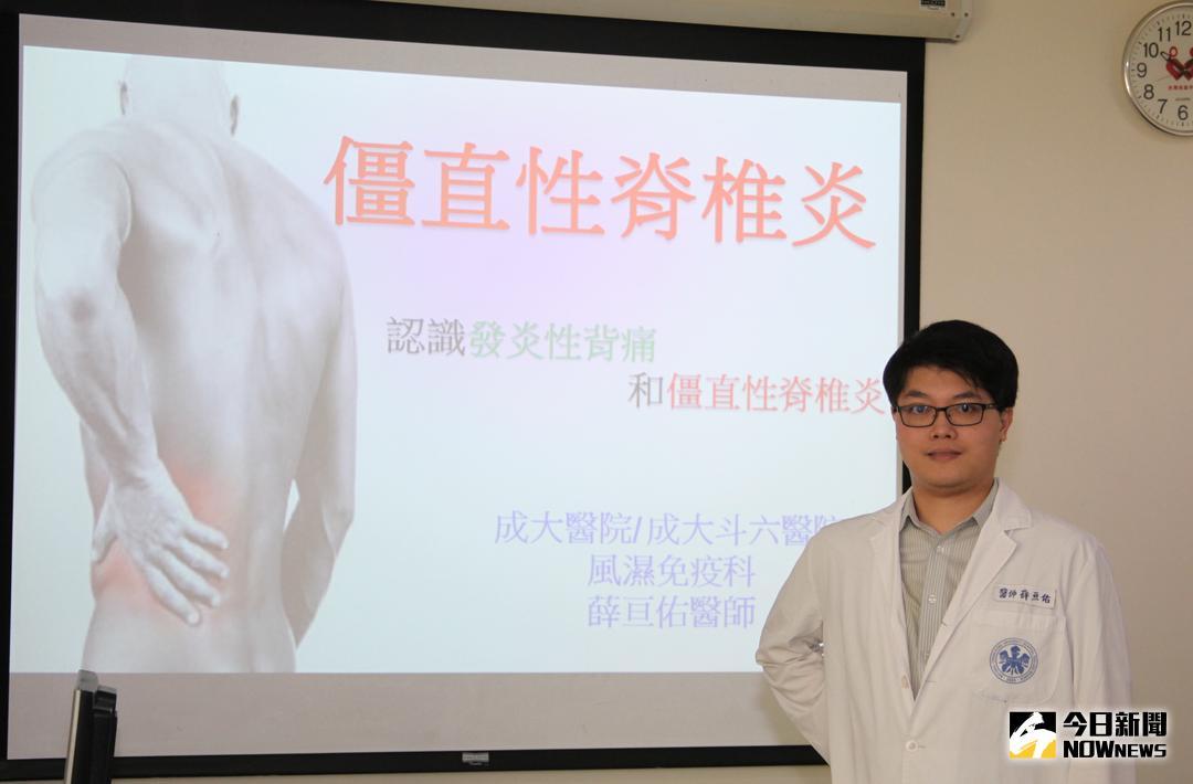 ▲醫師薛亘佑談到認識「發炎性背痛」和「僵直性脊椎炎」，遺傳基因扮演著重要角色。（圖／記者蘇榮泉攝，2018.07.03）