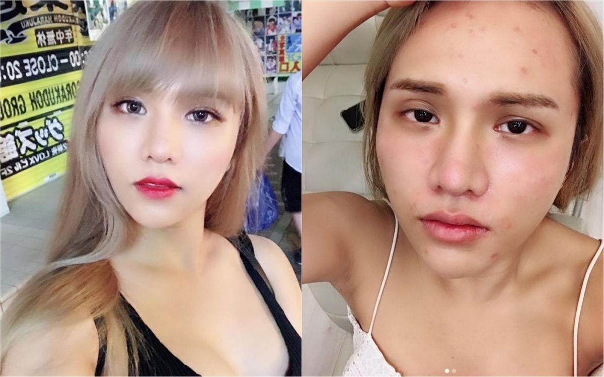 ▲小A辣為了愛美，做了許多醫美手術。（圖／翻攝小A辣IG, 2018.08.06）