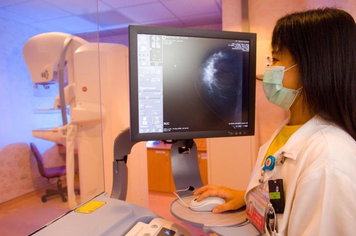 ▲乳房攝影檢查。（圖／聖馬爾定醫院提供 , 2018.08.06）