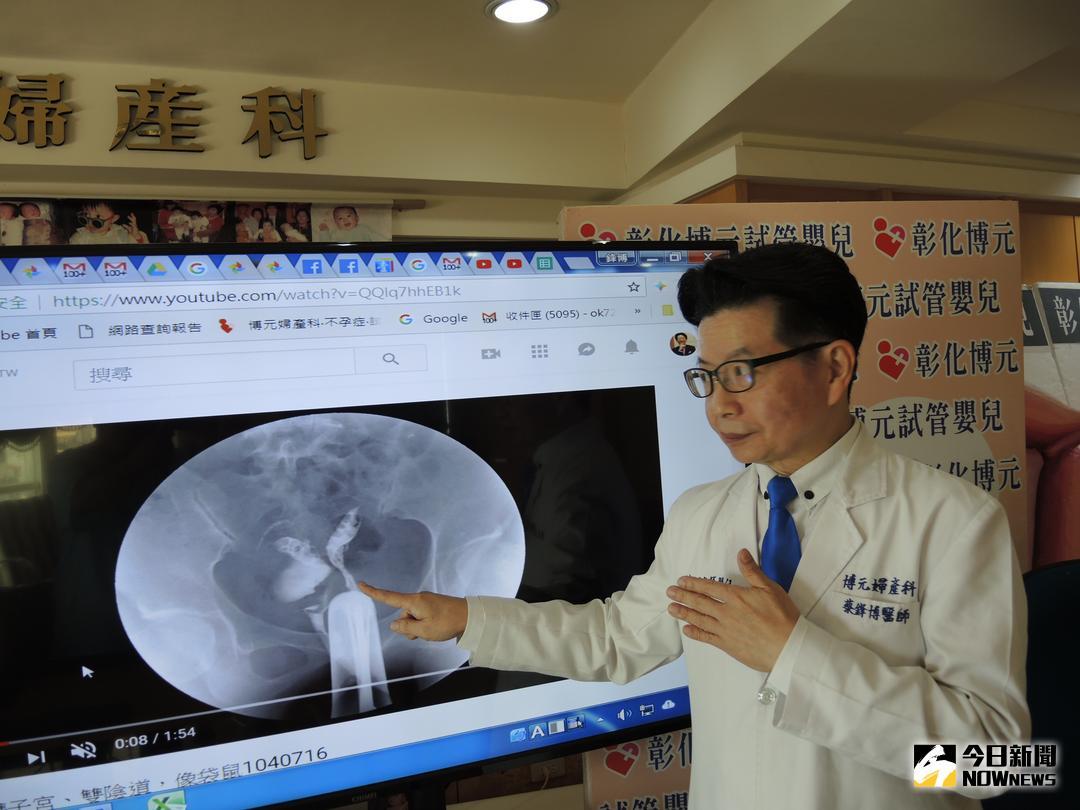 ▲雙子宮雙陰道孕婦較易流產、早產，婦產科醫師蔡鋒博說，孕婦要規律回診產檢，且日後較易發生胎位不正，恐需剖腹生產。（圖／記者陳雅芳攝，2018.08.13\\)