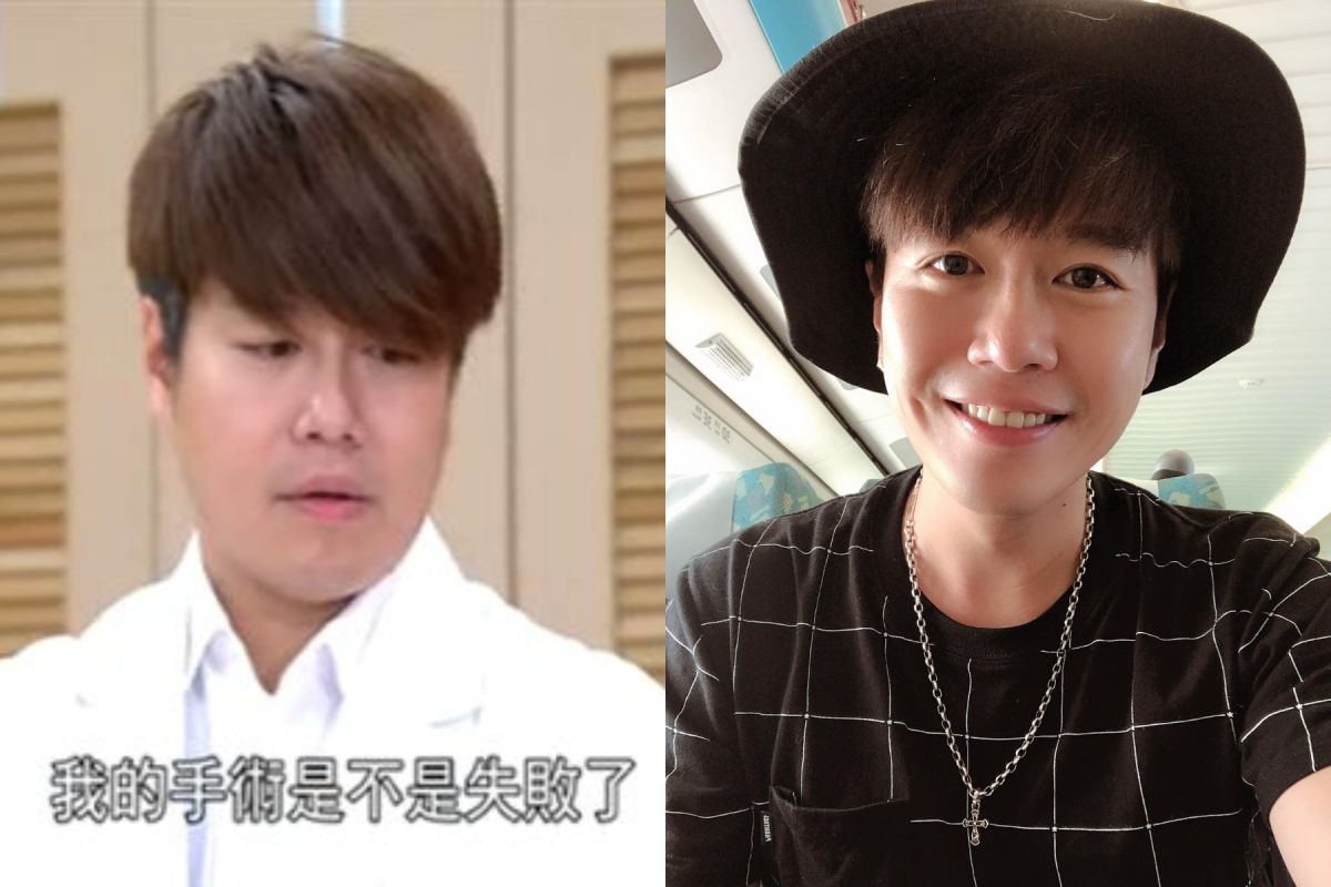 ▲李易 5 月客串《金家好媳婦》臉腫一圈，現已瘦下 11 公斤。（圖／翻攝YouTube、李易臉書, 2018.09.05）