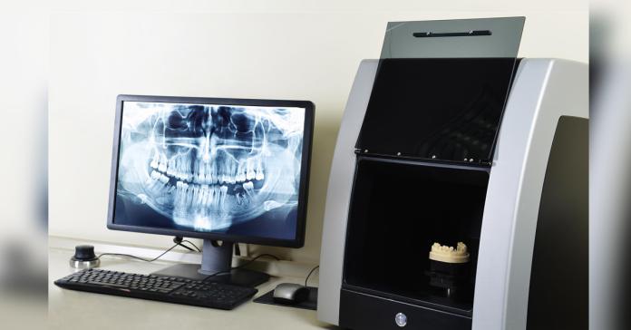 ▲「3D導航微創植牙」使用精密的3D放射攝影詳細評估，事先模擬好手術規劃，讓動刀的傷口最小，且暴露的時間最短。（圖／ingimage）