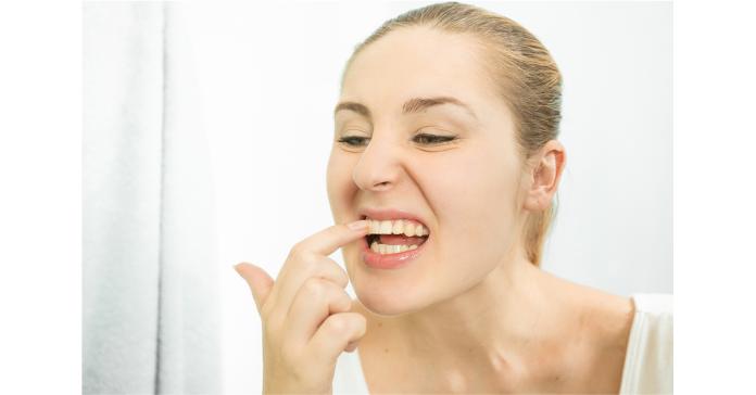 ▲坊間不少美容美甲店與醫美診所推出牙齒美容相關療程，但並非由正規牙科醫師評估及施作，毫無保障。（圖／ingimage）
