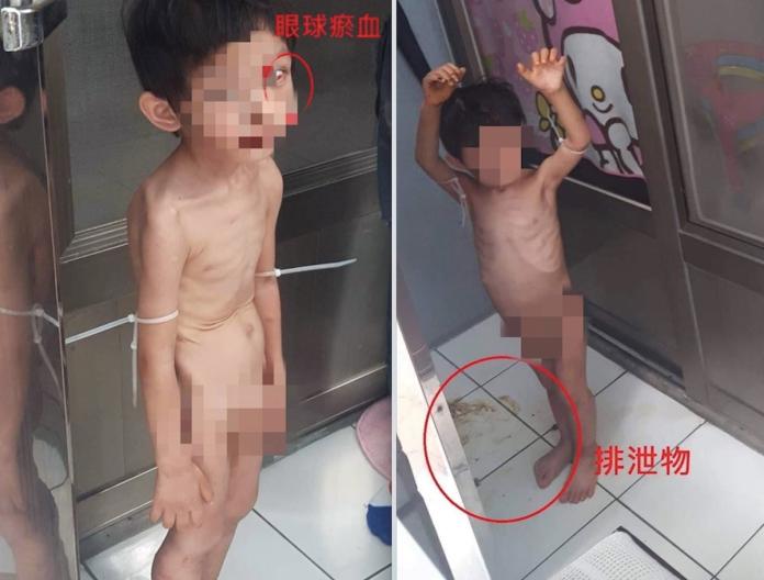 ▲新竹市驚傳虐童案件， 3 歲男童疑似遭到生父與同居人虐待。（圖／翻攝自爆料公社）