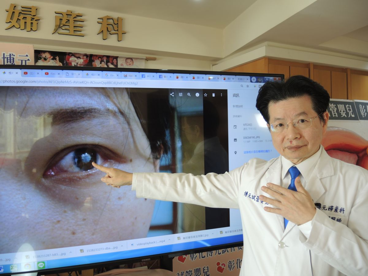 ▲罕見疾病「色素失調症」，罹病者皮膚出現色素沉著，有智能上的影響，癲癇發作、指甲發育不良、有視力不良或白內障等情況。（圖／記者陳雅芳攝，2018.10.01)