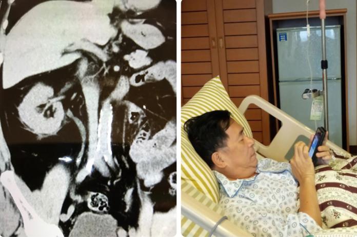 前總統陳水扁因腎結石住院，在病榻上仍掛懷而陳致中的選情。（圖／翻攝自新勇哥物語）