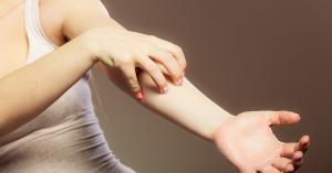 癢到睡不著! 中醫建議這樣吃遠離冬季乾癢 ▲乾燥性皮膚炎多發生於四肢部位,其中又以小腿脛骨前側的皮膚,或是手背及前臂最為常見,嚴重時全身皮膚乾燥、搔癢,一搔抓就會使紅疹範圍擴大。(圖/ingimage)