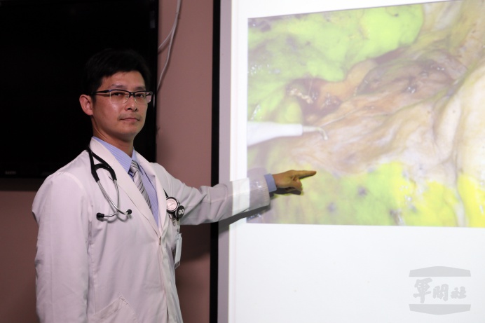 ▲ 臺中榮總胸腔外科主治醫師林志鴻表示，ICG螢光成像系統，在一般白光燈下，即可顯現ICG特有的螢光，病患在胸腔鏡手術下，精確切除腫瘤。（軍聞社記者卓以立攝）