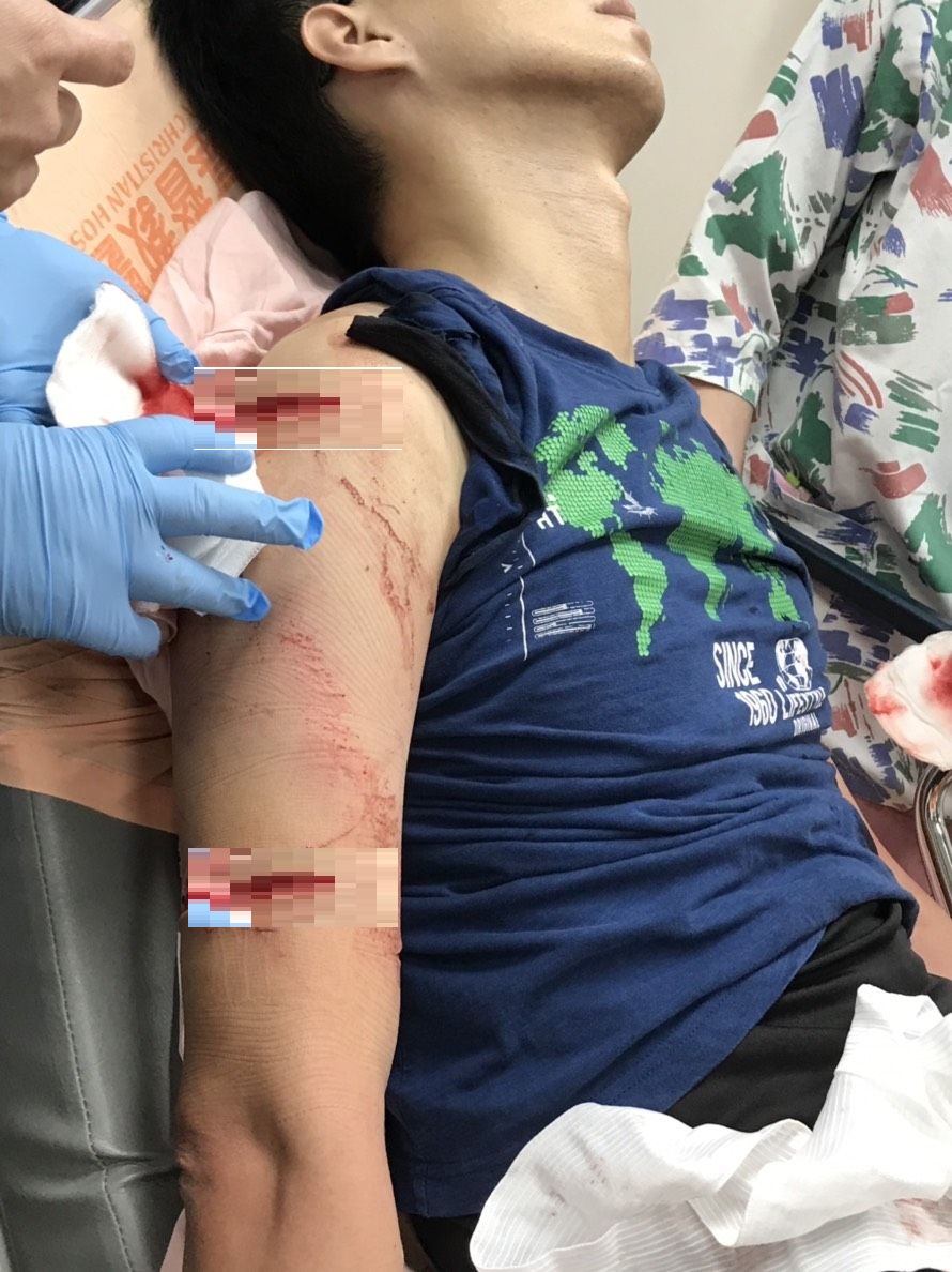 ▲和美警分局警員鎖皓恒支援衛生所人員協助將女子強制就醫，突遭持鐮刀砍殺，左右手臂與脖子遭鐮刀削掉肌肉，深可見骨。（圖／記者陳雅芳翻攝，2018.12.04)