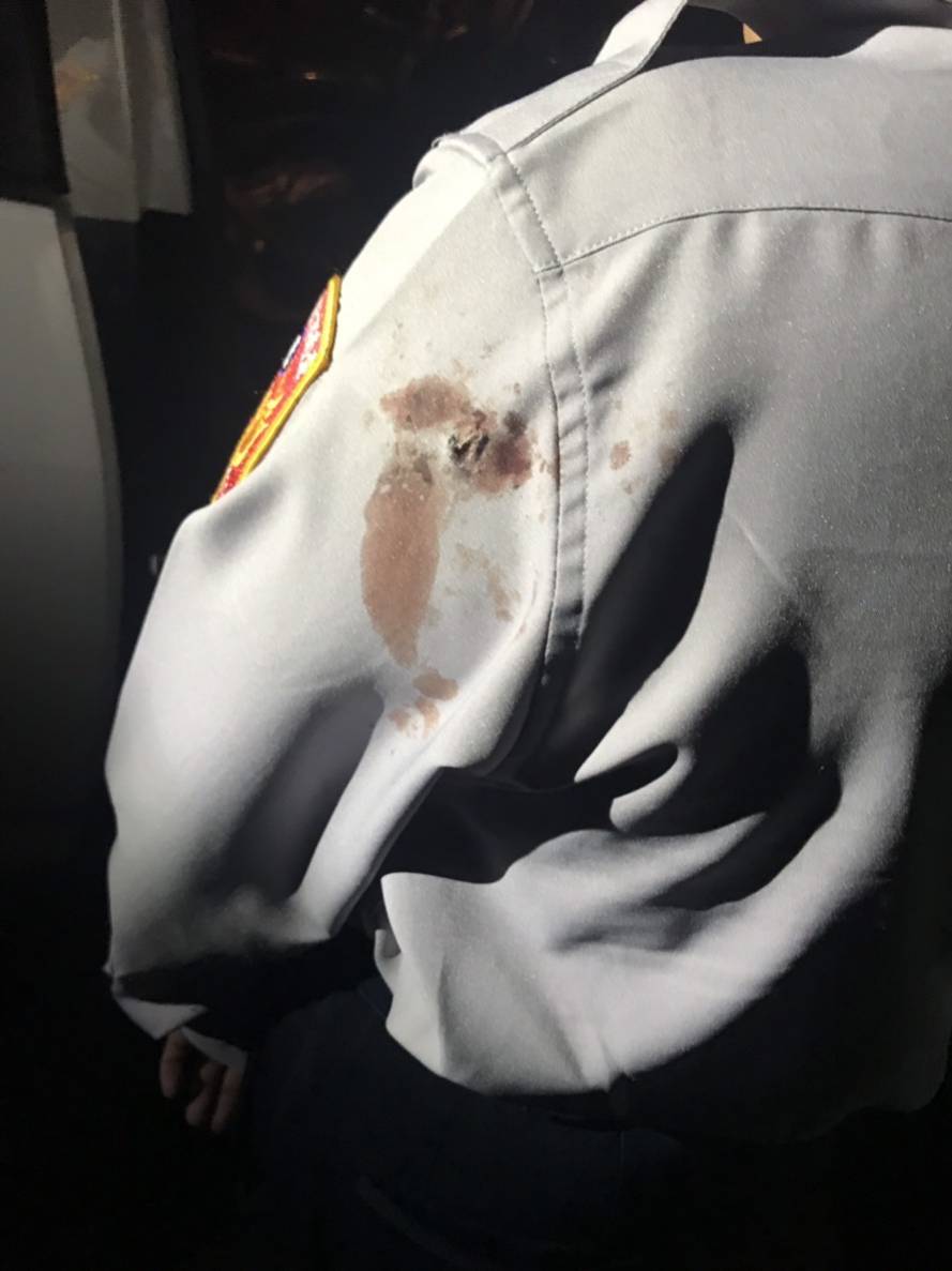 ▲台南襲警案顏姓員警左手臂中彈。(圖/記者陳聖璋翻攝)