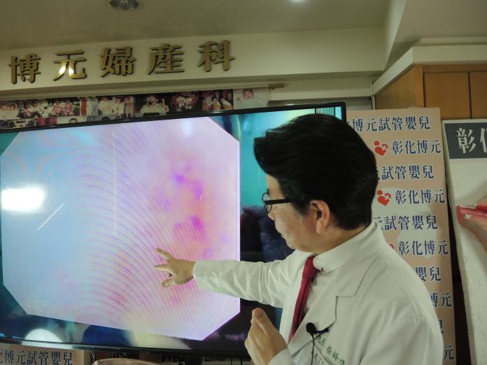 子宮頸癌