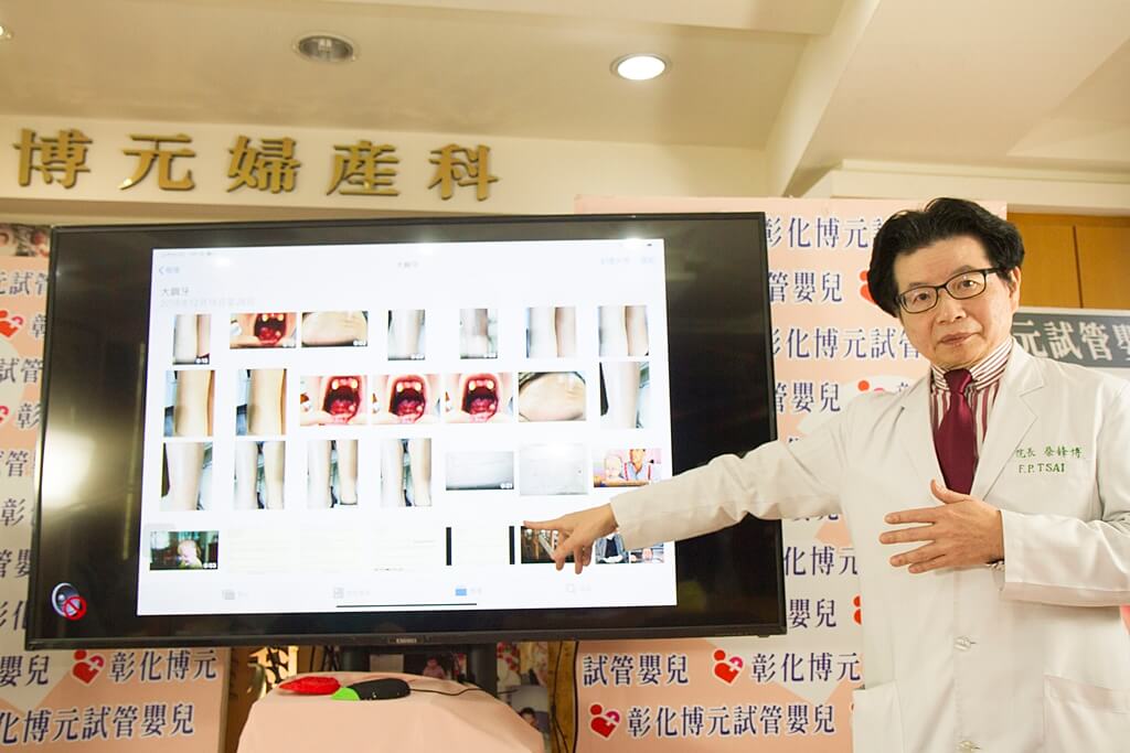 ▲罹患罕見疾病「海勒曼-史德萊夫症候群」會出現牙齒發育不全或歪斜，毛髮稀少顏色淡，特別是頭皮，有可能須作氣切，可藉由胚胎快篩阻絕罕見疾病的遺傳。（圖／記者陳雅芳攝，2019.01.07）