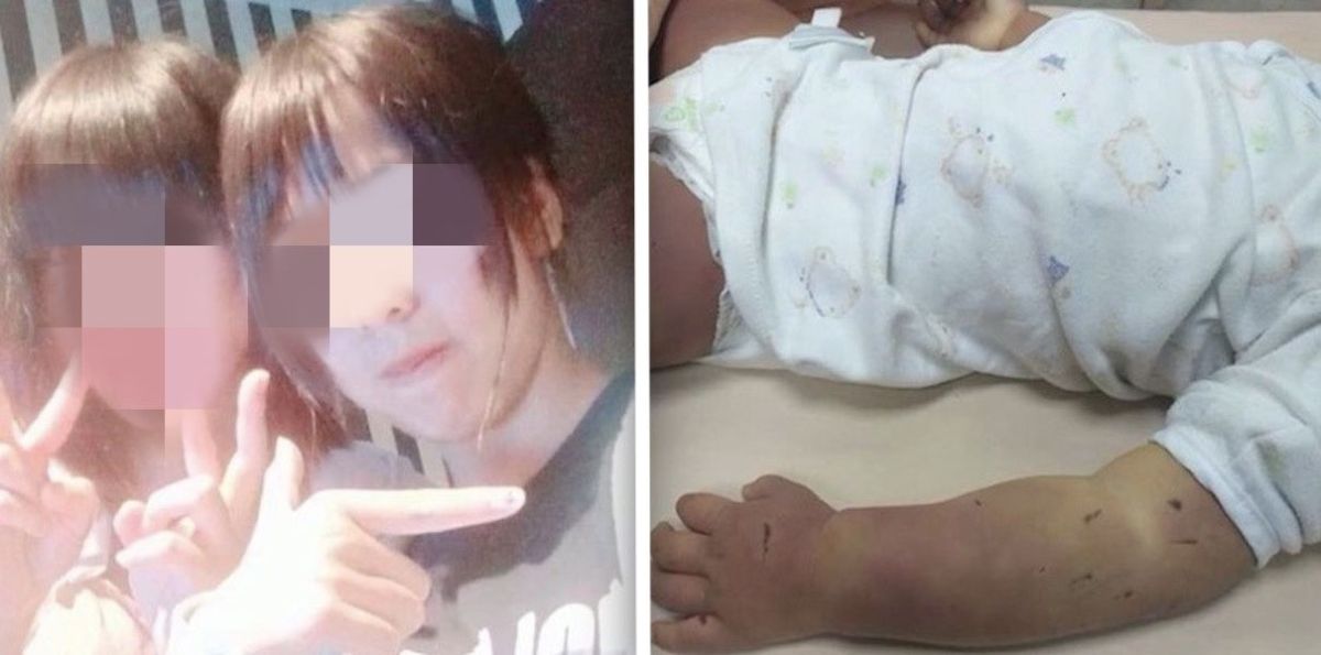 ▲台南市一名 1 歲半女童慘遭活活虐死，經警方漏夜徹查，目前將女童的 17 歲生母，以及同屋的 28 歲李姓計車司機、女童生母的 20 歲表姐、以及 26 歲何姓表姐夫列為涉案嫌疑人，而這 4 人也都承認了確實有打小孩，而且是「看到小孩哭鬧就打！」（圖／截自臉書）