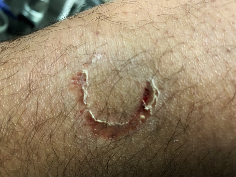 ▲第三分局員警廖子遭退伍海龍咬一口（圖／記者鄧力軍翻攝, 2019.01.17）