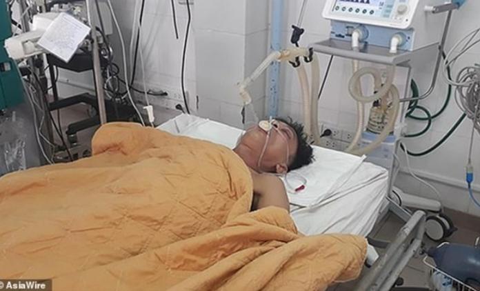 越南一名男子因酒精中毒命危，醫生「以毒攻毒」，注入15瓶啤酒到他體內，成功保住一命。（圖／翻攝DailyMail）