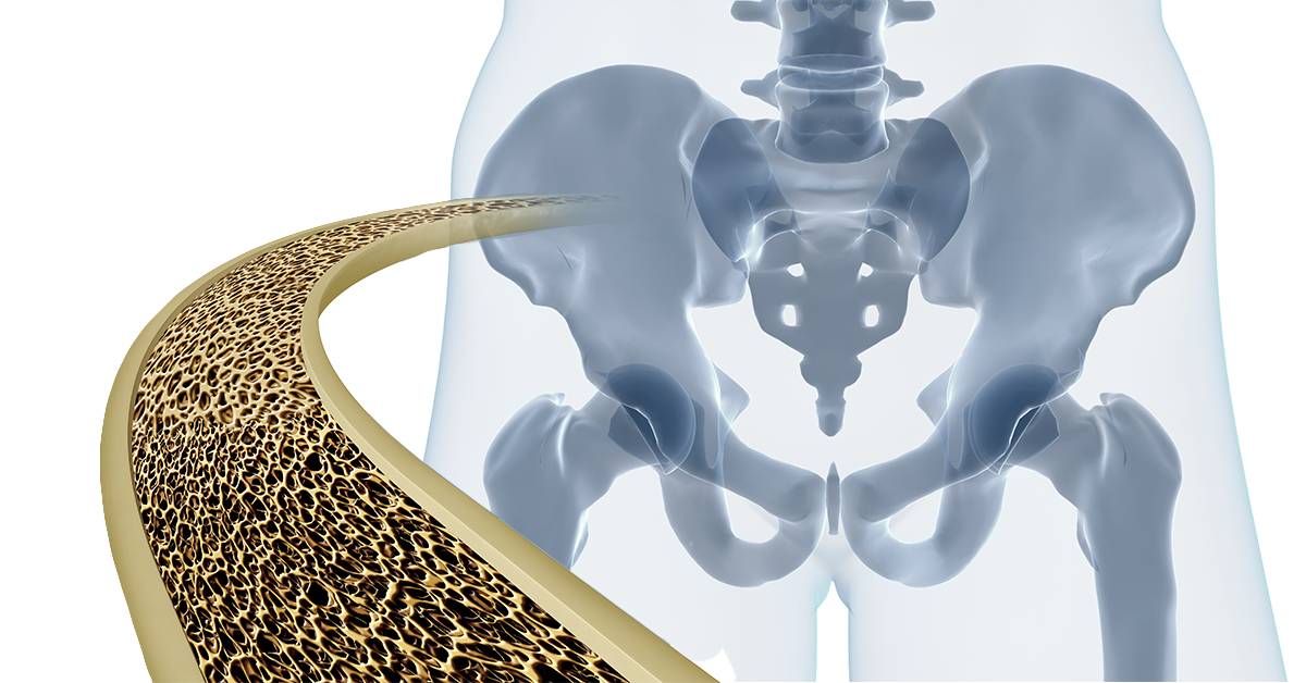 ▲一項研究指出，其實老年男性也有骨質流失現象，且通常消極治療。（圖／ingimage）