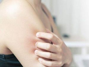 ▲異位性皮膚炎患者長期皮膚搔癢脫屑、反覆發作，可能嚴重影響生活。（圖／ingimage）