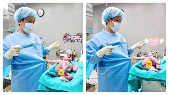 狂！新生兒緊扯手術袍要和醫師輸贏　網笑：投錯胎想回去
