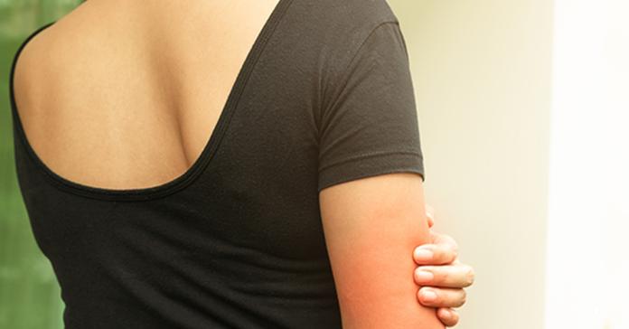 ▲異位性皮膚炎是台灣常見皮膚疾病，全台約有超過200萬名患者。（示意圖／取自ingimage）