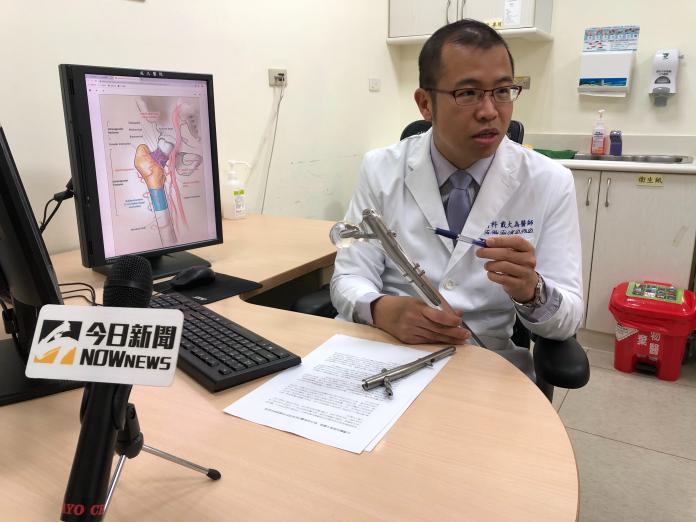 台灣醫材大躍進　8旬婦骨折植「骨髓內釘」6個月重新站起
