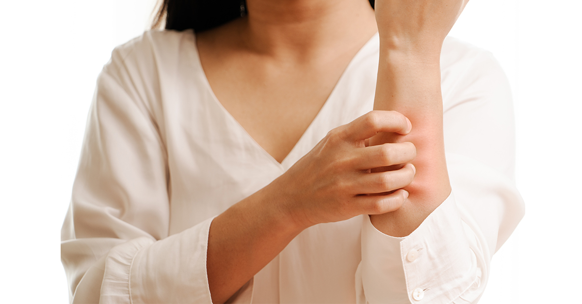 ▲目前正值季節交替之際，加上北部多溼冷氣候，皮膚又容易出狀況，除透過中藥治療調理，還須從日常生活多管齊下防護，才能有助減緩皮膚病的侵襲。（圖／ingimage）