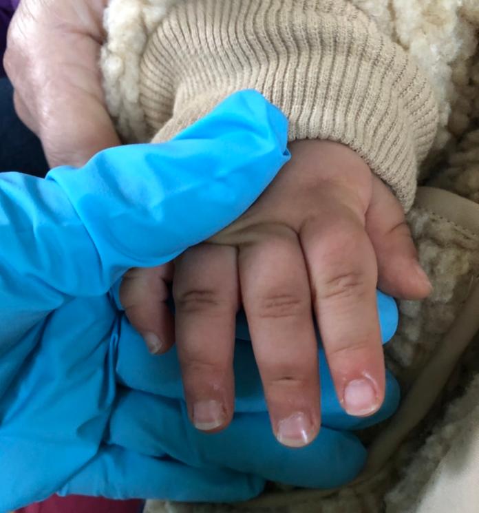 2歲童慘遭鋁門窗夾住手指　救護員搶救淚人兒脫困
