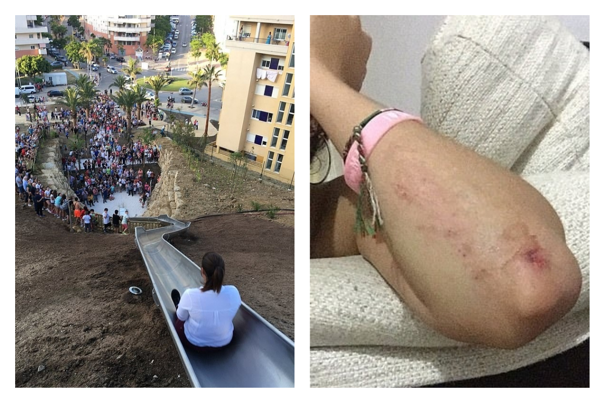 ▲溜滑梯啟用後不到 24 小時，就有市民使用後受傷，包括手肘受損，開幕一天便被下令關閉。（圖／翻攝自網路）