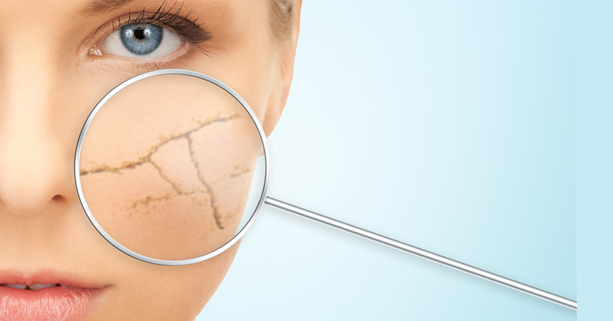 ▲一旦細胞得不到充足的氧氣供應，血液循環就會變慢、變差，體內的黑色素等老廢物質無法順利排出，臉部肌膚就會顯得黯淡無光、粗糙，甚至連痘痘都跟著來。（圖／ingimage）