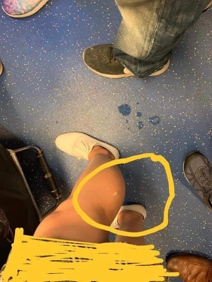▲女乘客的小腿上及車廂地上沾滿白色液體，疑似精液。（圖／翻攝自香港交通突發報料區）