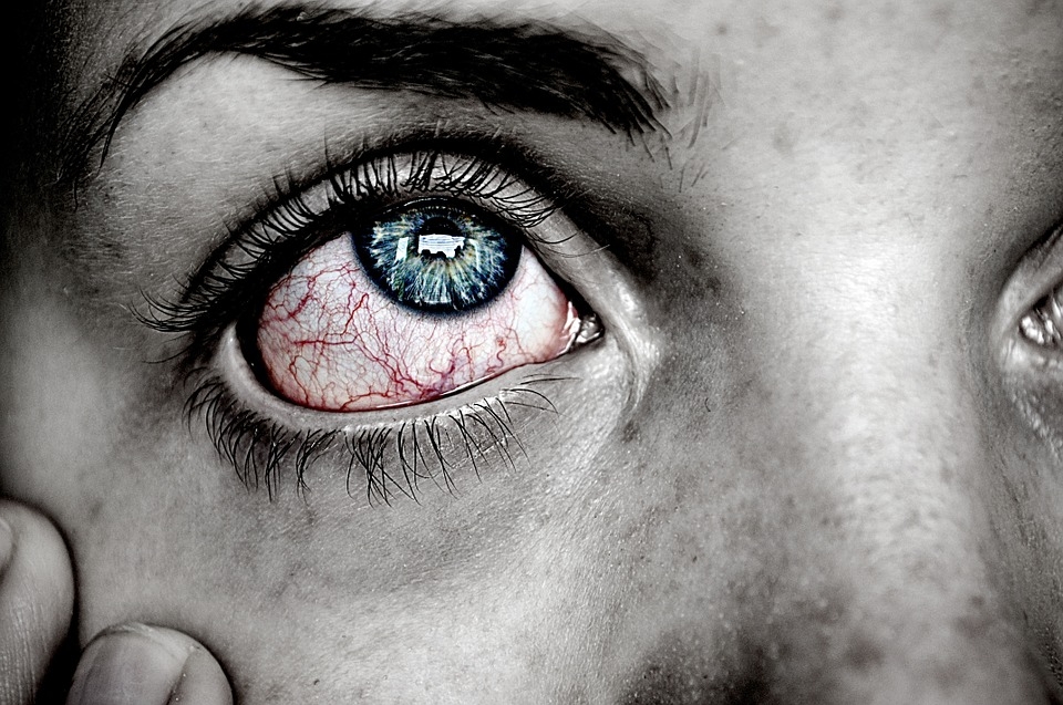 眼皮跳的醫學根據。（圖／Pixabay）