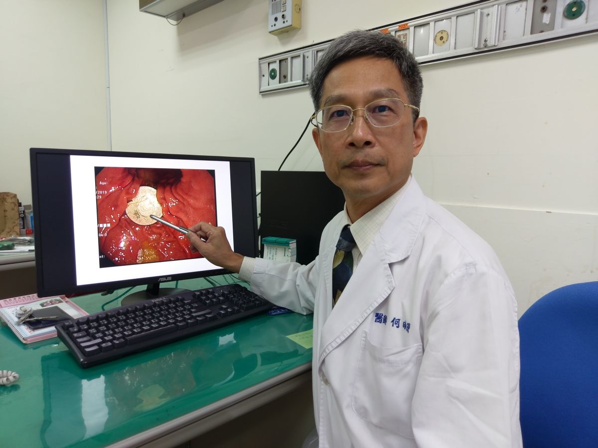 ▲小男童誤吞一元硬幣，母親想挖出卻越推越深，醫師警告千萬別這麼做。（圖／豐原醫院提供）