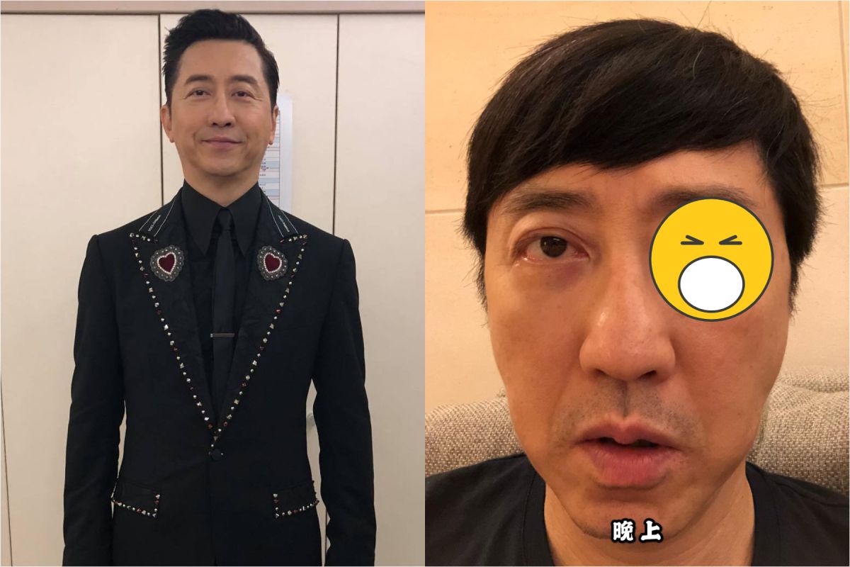  ▲庾澄慶健康出狀況。（圖 / 翻攝臉書）