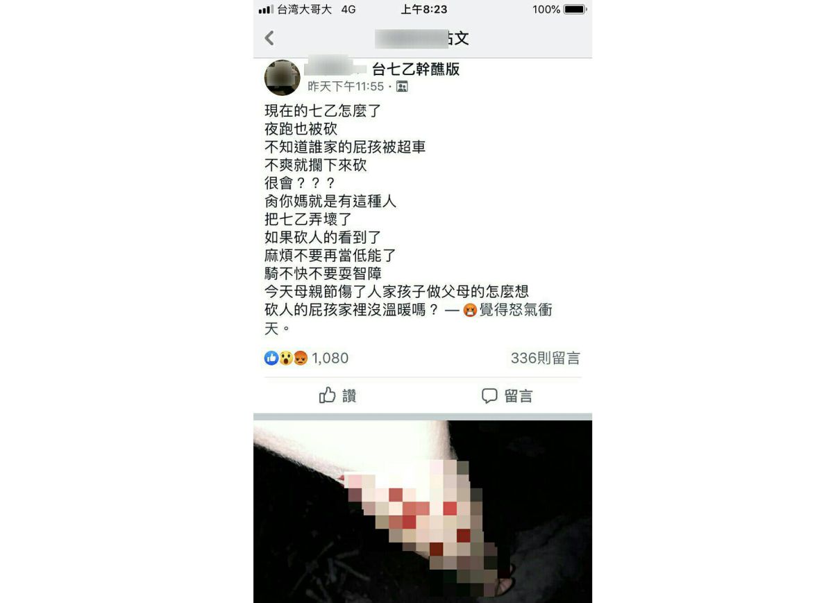 ▲鄭姓男子將由LINE傳來的流血照片，未經查證就貼近臉書社團並宣稱有人在台7乙線夜騎就遭到攔車砍傷，引發網友熱議。（圖／翻攝「台七乙幹譙版」）