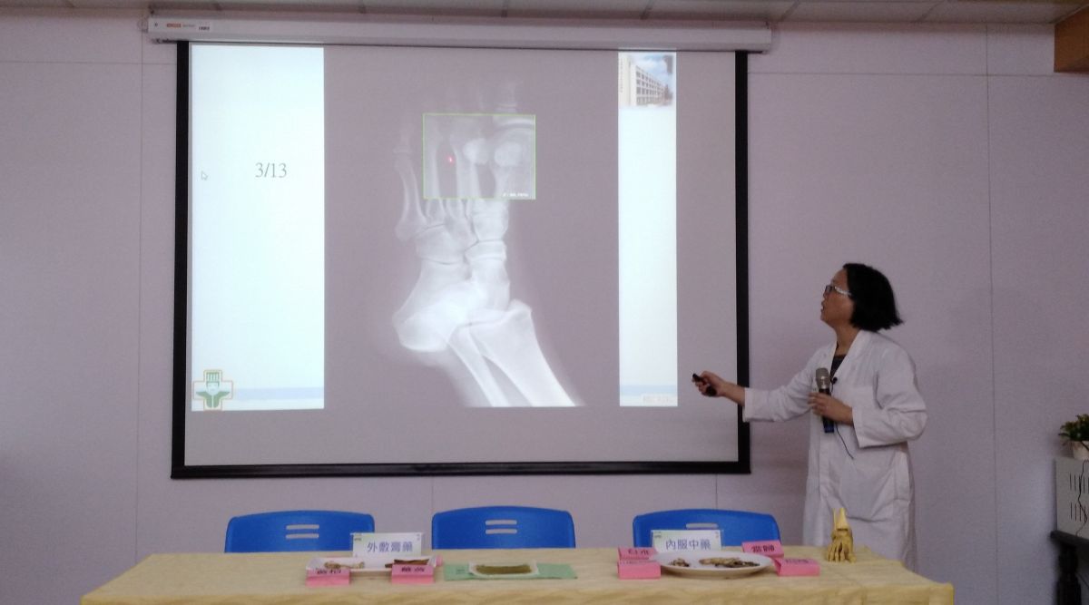 ▲中醫部賴英秀醫師講解「蹠骨骨裂」。（圖／記者洪佳伶攝，2019.06.18）