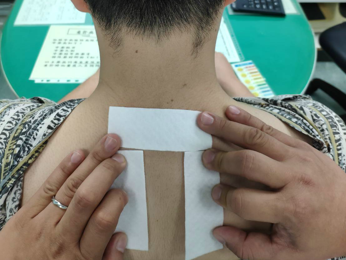 ▲中醫「三伏貼」能減緩肺部過敏性疾病發作的頻率與嚴重程度。（圖／奇美醫院提供）