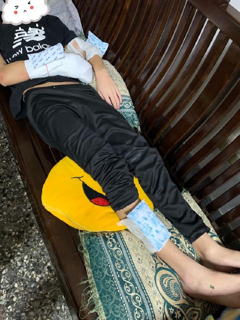 ▲「三胞胎/四寶媽/我是小涵媽」的姪子遭打斷手腳、腎破、腦震盪（圖／「三胞胎/四寶媽/我是小涵媽」臉書提供）