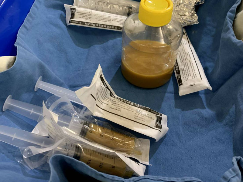 ▲長庚成立微菌銀行，目前以微菌叢植入術治療困難梭菌感染。（圖／長庚醫院提供）