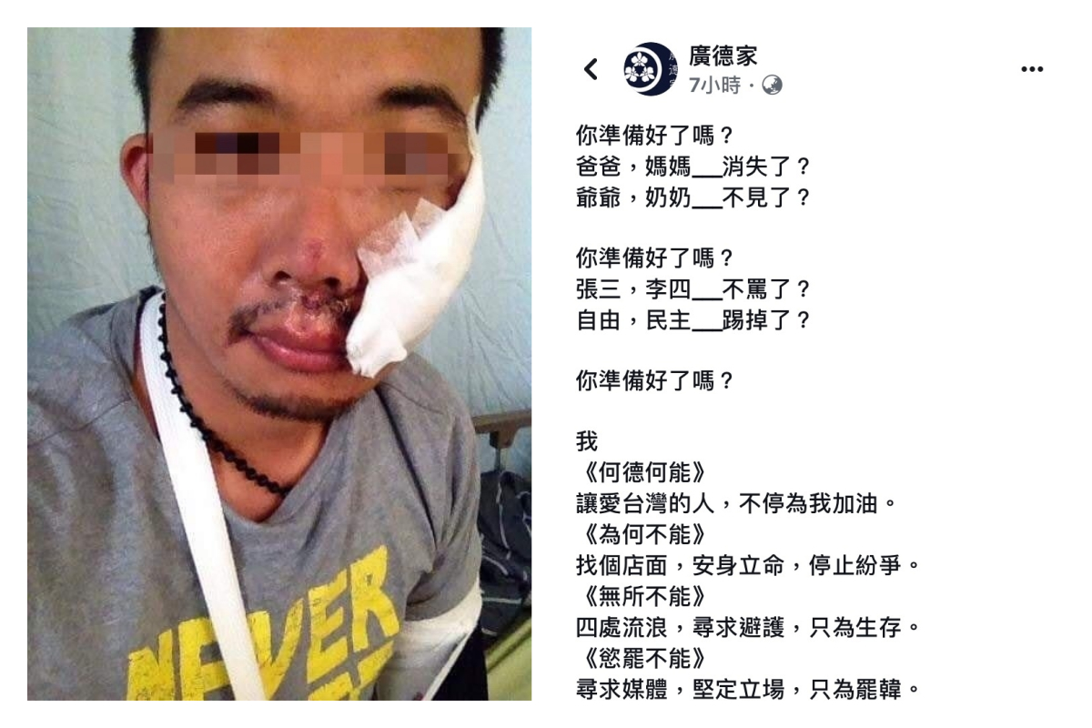 ▲廣德家老闆於今（ 15 ）日凌晨在臉書 PO 出一篇五百多字的文章，更加上一張臉部、手部受傷的照片並質問大家「準備好了嗎？」。（圖／翻攝自廣德家臉書）