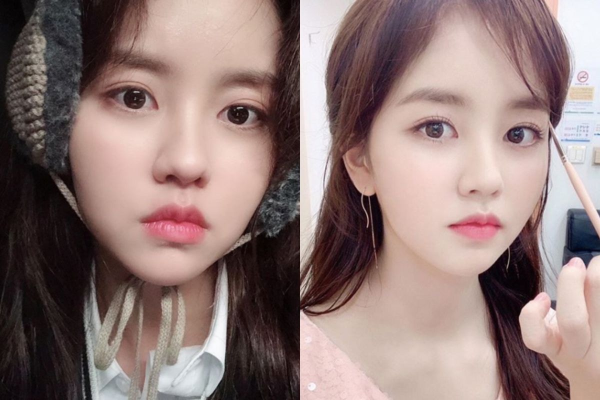 ▲金所泫拍攝出意外。（圖／金所泫IG）