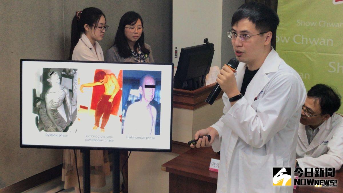 ▲彰濱秀傳醫院神經內科林煒醫師表示，「Lubag症」嚴重的話會有肢體僵硬，無法生活自理。（圖／記者陳雅芳攝，2019.07.23）