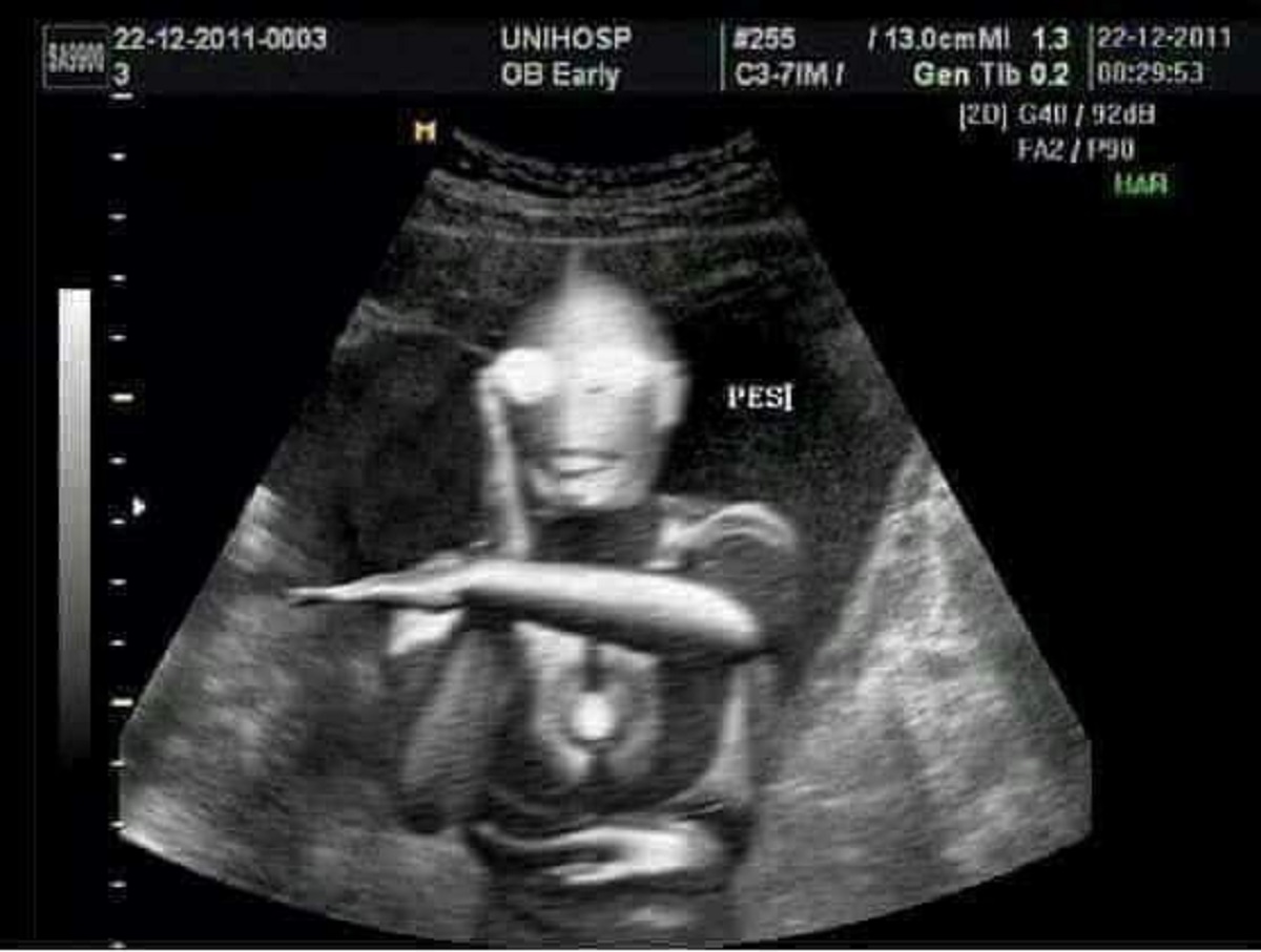 ▲通常「懷孕」對一個家庭來說是開心的到來，但如果肚子裡的小孩「有可能」不是自己的，那可能就真的當冤大頭了。（示意圖／翻攝自《爆料公社》）