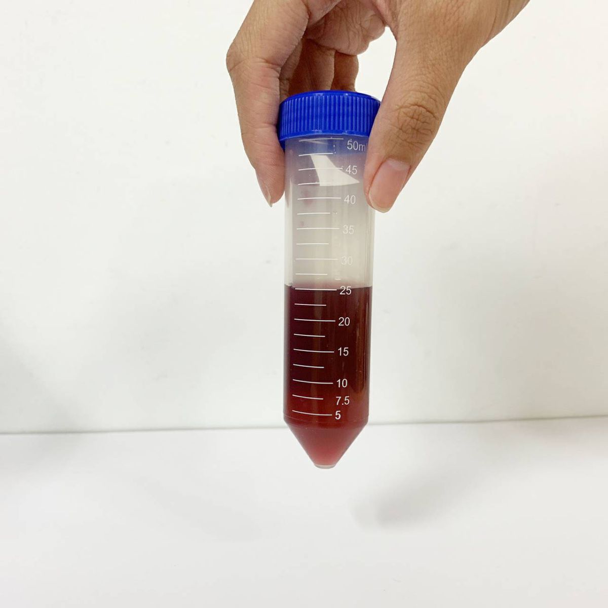 ▲女子患紫質症導致腹痛、嘔吐。（圖／長庚醫院提供）