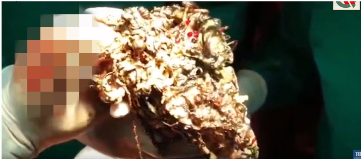 ▲ 印度一名女子疑似罹患異食癖，竟將大量金屬吞下肚。（圖／翻攝英國每日郵報）