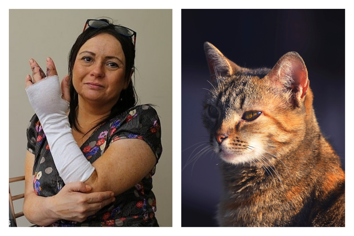 ▲婦人被貓抓傷，差點喪命。（合成圖／右為示意圖，非當事貓咪。取自 SWNS 、 Unsplash ）