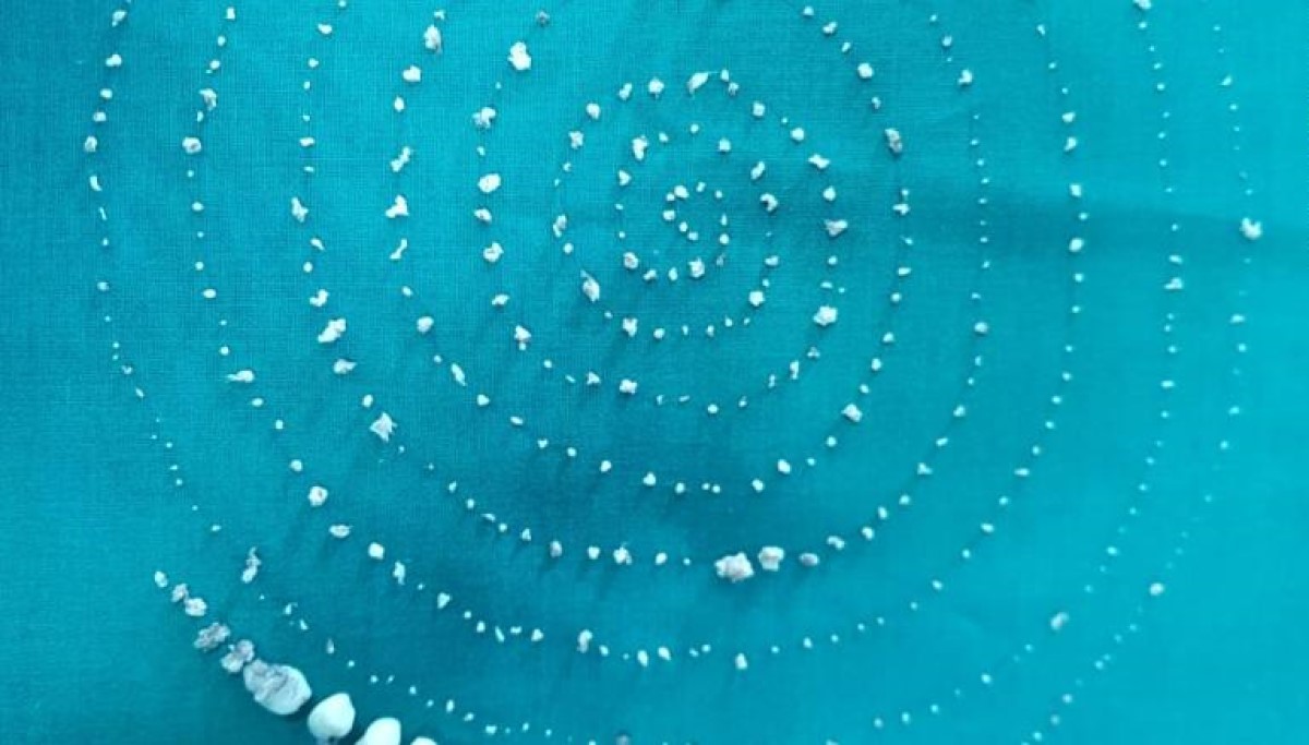 ▲印度一名男童下巴疼痛，嘴裡竟夾出 526 顆牙齒。（圖／翻攝自 CNN ）